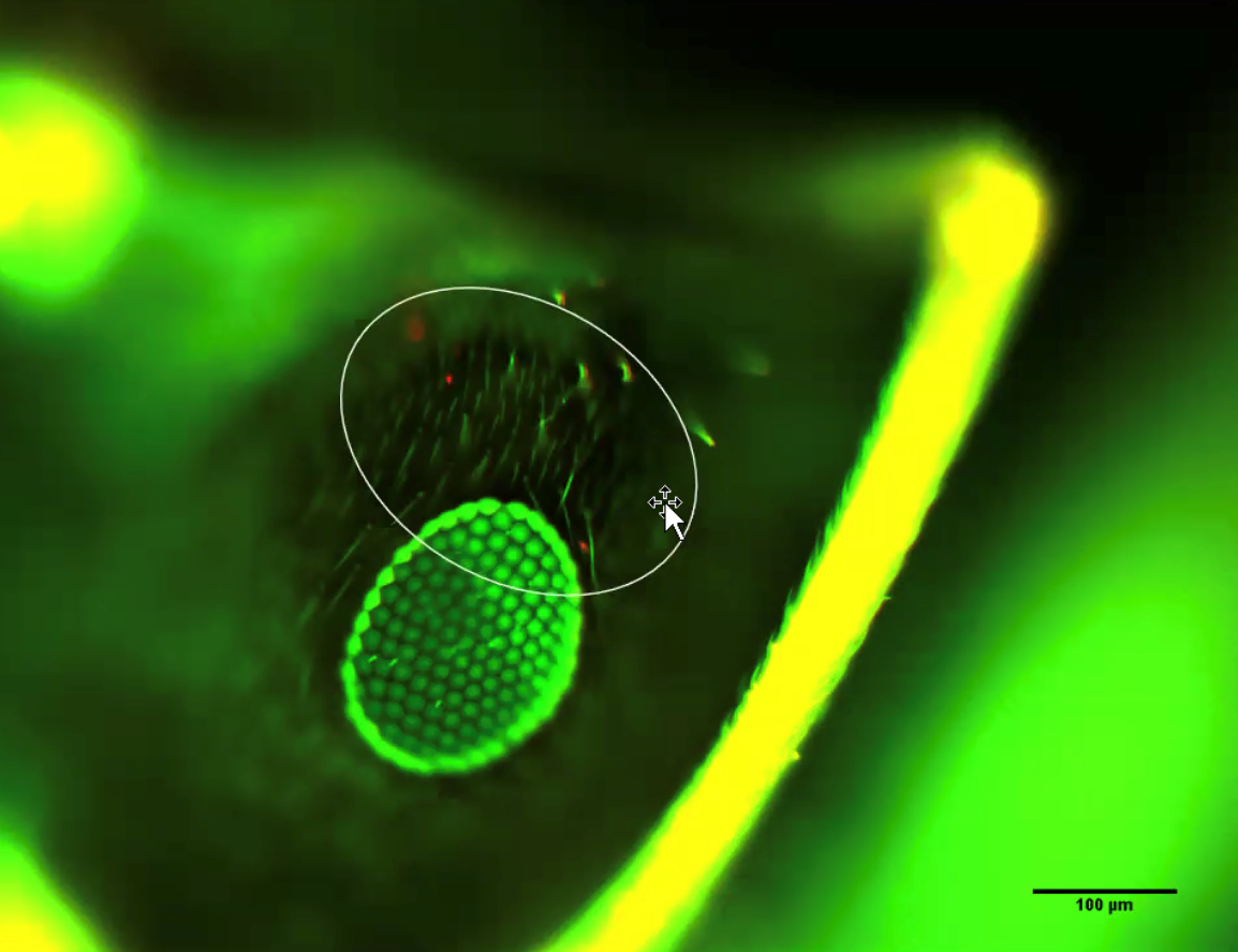 Fluorescent spores on Lasius neglectus head